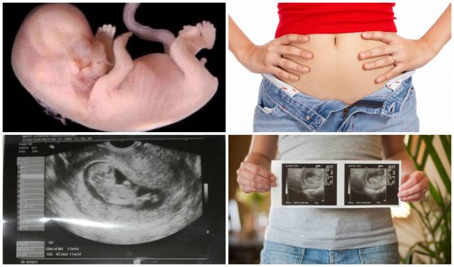 11 тиждень вагітності: що відбувається, розвиток плода, відчуття мами
