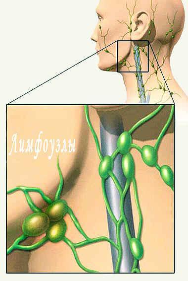 Болять лімфовузли на шиї: причини, що робити і як лікувати