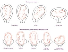 Передлежання плаценти при вагітності: УЗД, як визначається і класифікується?
