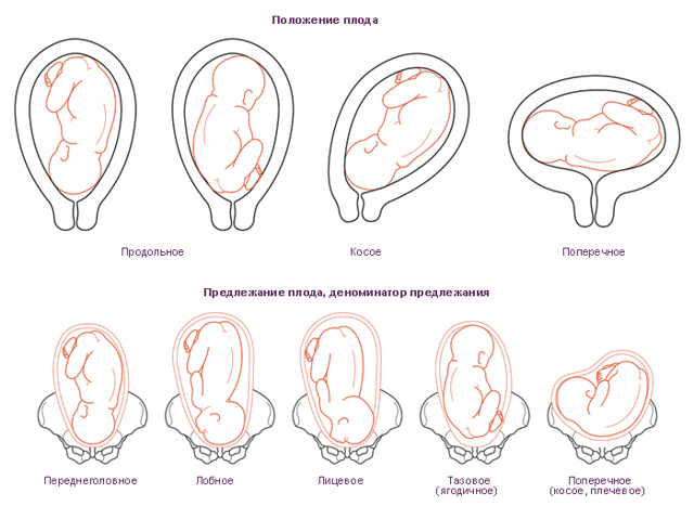 Передлежання плаценти при вагітності: УЗД, як визначається і класифікується?