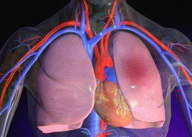 Тромбоемболія легеневої артерії: як діагностується, причина і які можуть бути ускладнення