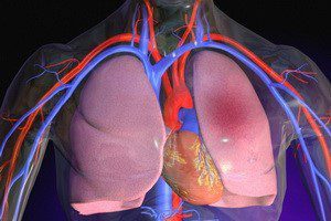 Тромбоемболія легеневої артерії: як діагностується, причина і які можуть бути ускладнення