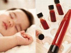 Як беруть кров з вени у новонародженого, немовляти, підготовка до аналізу крові з вени