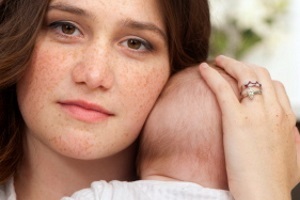 Пігментація при вагітності на обличчі, як позбутися від пігментації шкіри при вагітності