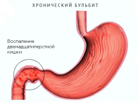 Болить у правому боці під ребрами, з чим це пов'язано?