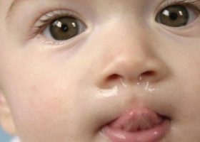 Білі соплі у дитини: чому і чим краще лікувати?
