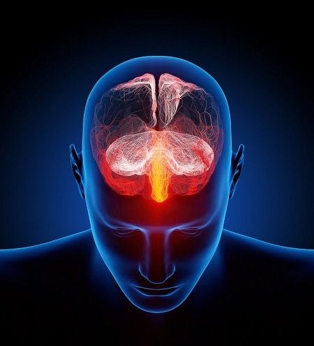 Електроенцефалограма головного мозку: що показує, розшифровка результатів