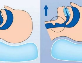 Хропіння: чому з'являється, рекомендації як від нього позбутися хропіння в домашніх умовах