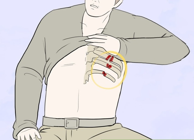 Що треба зробити при травмі грудної клітини, лікування при переломах грудини і ребер