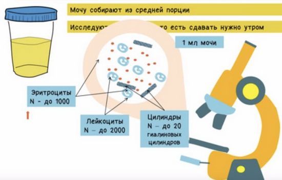 Розшифровка аналізу крові та аналізу сечі по Нечипоренко: що означають результати аналізів сечі і крові