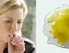 Жовта мокрота при кашлі: причини утворення, діагностика та методи лікування