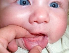 Зубний біль у дитини - що дати малюку, ефективні засоби для дітей