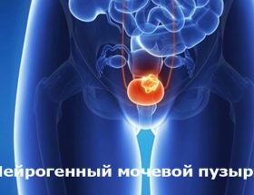 Нейрогенний сечовий міхур: лікування у жінок, дітей і чоловіків, профілактика і прогноз