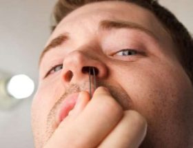 Сикоз носа: лікування, причини та можливі симптоми