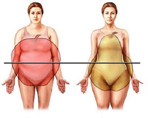 Як визначити ожиріння 1, 2, 3, 4 ступеня за індексом маси тіла, методи лікування