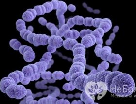 Бактеріальний тонзиліт: причини розвитку, супутні симптоми, діагностика та методи терапії