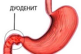 Хворобливе ущільнення в животі у жінок: можливі причини і методи діагностики 