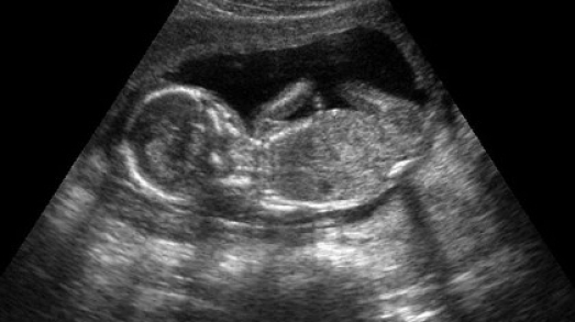 15 тиждень вагітності: що відбувається, відчуття в животі, фото живота