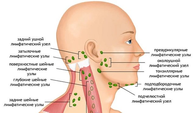 Тонзіллярние лімфовузли збільшені: причини, симптоми і чим лікувати