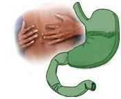 Диспепсія шлунка: симптоми, причини, діагностика та лікування хвороби