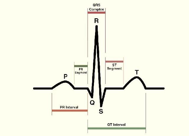 Як розшифрувати ЕКГ серця і діагностувати патології серця по ЕКГ