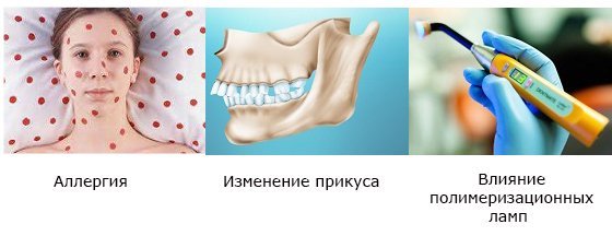 Пломбування зубних каналів: як проводиться, болю після пломбування