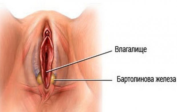 Бартолініт: симптоми і лікування, операція, бартолініт при вагітності