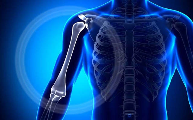 Осколковий перелом плечової кістки: причини, симптоми, лікування, ризики