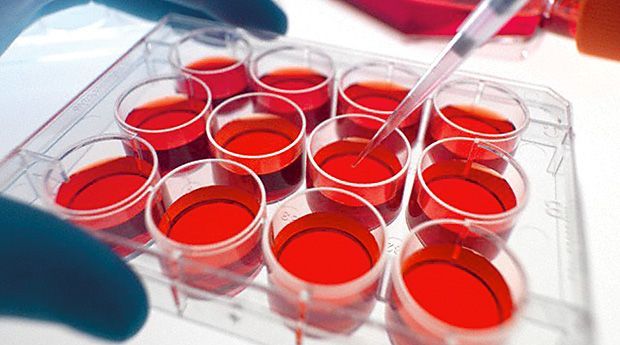 Стовбурові клітини людини: застосування пуповинної крові, лікування стовбуровими клітинами