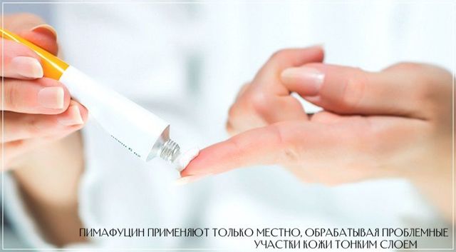 Пімафуцин свічки: інструкція із застосування, аналоги, Пімафуцин при вагітності