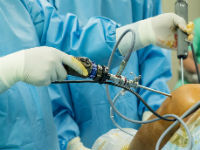 Артроскопія суглобів: операція і підготовка до неї, секрети успішної реабілітації
