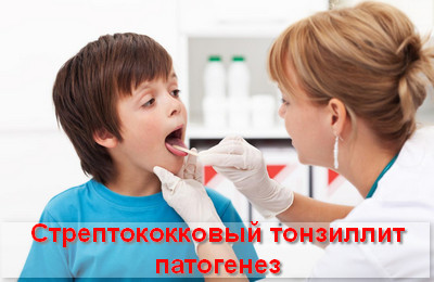 Стрептококова ангіна: симптоми і лікування у дорослих і дітей, профілактика