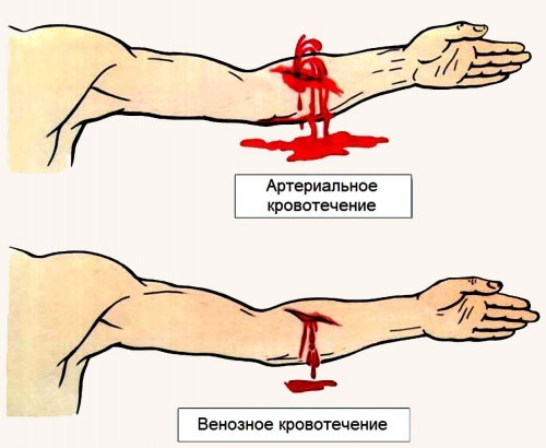 Як зупинити кров з ранки