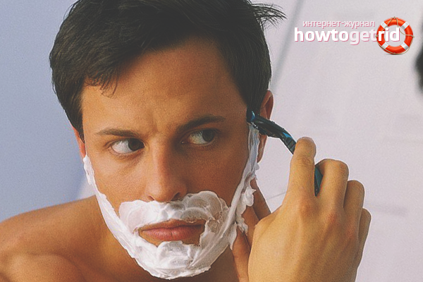 Прищі і роздратування після гоління: поради, як позбутися від роздратування після гоління і прищів