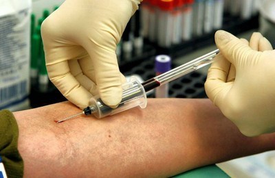 Аналіз крові на згортання: порядок призначення, правила підготовки, розшифровка результатів
