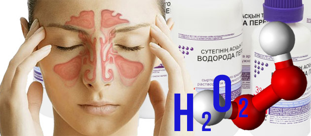 Лікування гаймориту перекисом водню: як промивати ніс і чи можна?