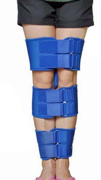 Вальгусна деформація колінних суглобів у дорослих і дітей: причини, лікування