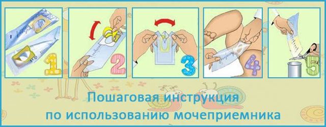 Аналіз сечі по Нечипоренко: як збирати, що показує, норми у жінок, дітей і чоловіків