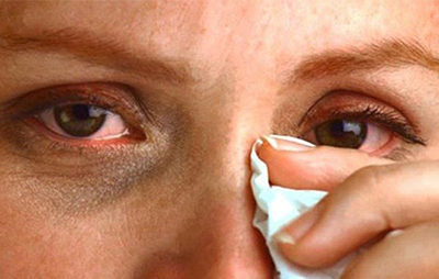 Сверблять очі і нежить, закладений ніс: причини і профілактика