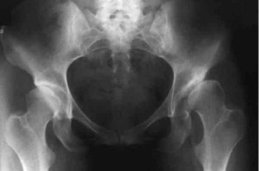 Рентген хребта: що показує, підготовка, як часто можна робити рентген