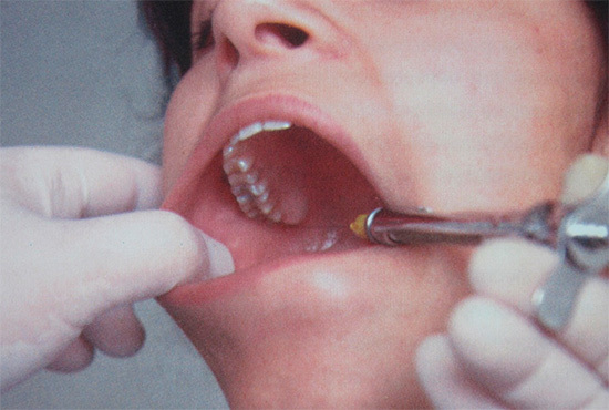 Опухла щока, але зуб не болить: як зняти пухлина, що це може бути, що робити