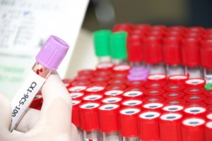 Як розріджувати кров при високому гемоглобіні?