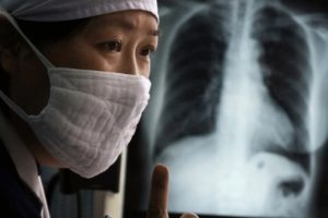 Посів мокроти на туберкульоз: скільки робиться, розшифровка, як збирати і здавати