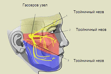 Неврит (невралгія) лицьового нерва - симптоми, лікування, ефективні препарати і масаж при невриті лицьового нерва