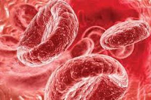 Чому знижений гемоглобін і утворився тромб