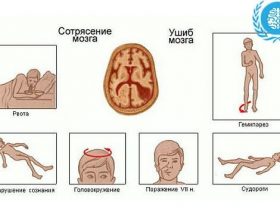 Струс головного мозку: симптоми і лікування, як надати першу допомогу?