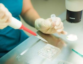 Аналіз спермограми: правила підготовки до аналізу, які патології можна виявити, розшифровка результатів, основні критерії обстеження