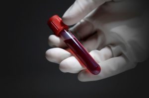 Аналіз крові за методом ІФА: розшифровка, призначення, необхідність визначення антитіл.