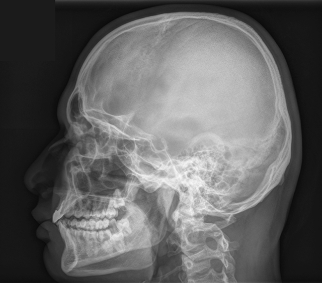 Рентген голови: що показує, як роблять, рентген при струсі у дитини і дорослого