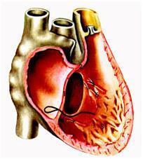Серцева недостатність: стадії, функціональні класи, ступеня, форми